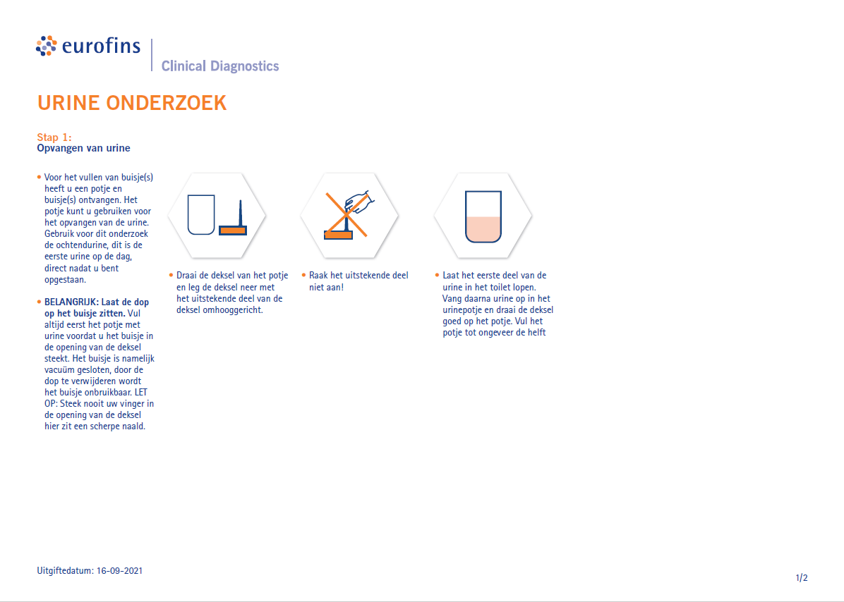 urine onderzoek 1