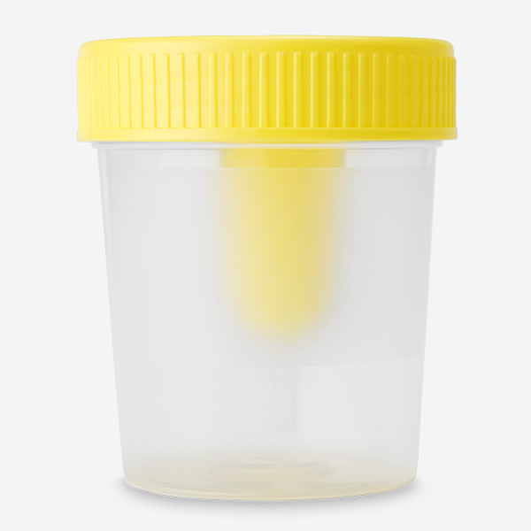 urine-potjes-achterkant